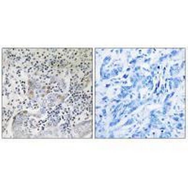 SESN1 Antibody in Immunohistochemistry (Paraffin) (IHC (P))