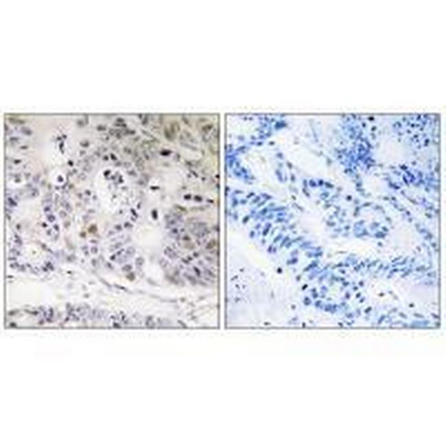 UBTD1 Antibody in Immunohistochemistry (Paraffin) (IHC (P))