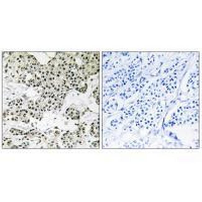 THOC5 Antibody in Immunohistochemistry (Paraffin) (IHC (P))