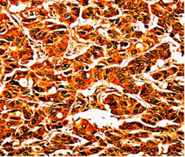 UPK3B Antibody in Immunohistochemistry (Paraffin) (IHC (P))