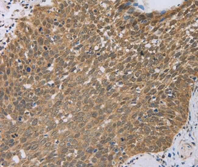 PCP4 Antibody in Immunohistochemistry (Paraffin) (IHC (P))