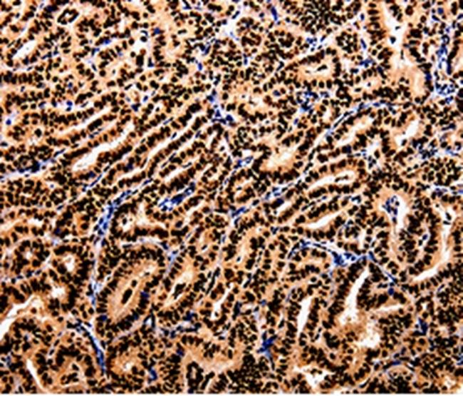 APIP Antibody in Immunohistochemistry (Paraffin) (IHC (P))