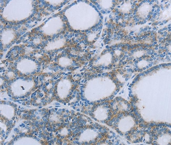 EGFL7 Antibody in Immunohistochemistry (Paraffin) (IHC (P))