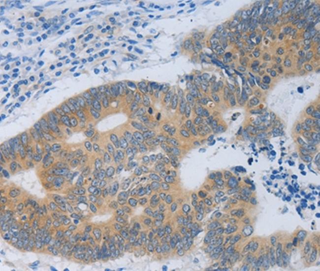 MT2A Antibody in Immunohistochemistry (Paraffin) (IHC (P))