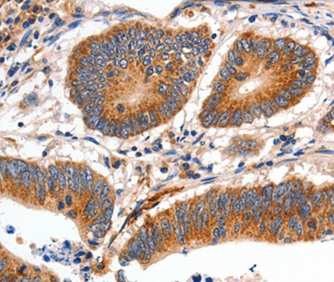 MYH7 Antibody in Immunohistochemistry (Paraffin) (IHC (P))