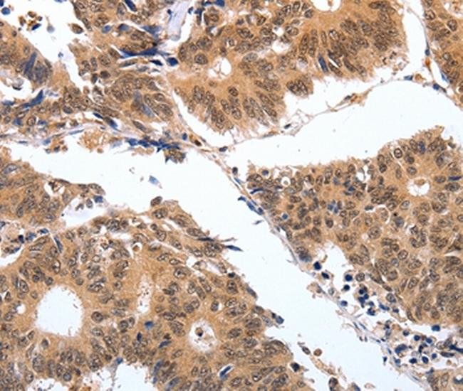 PGC Antibody in Immunohistochemistry (Paraffin) (IHC (P))