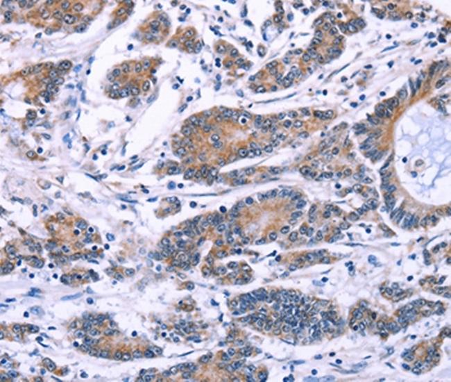 Synaptotagmin 4 Antibody in Immunohistochemistry (Paraffin) (IHC (P))