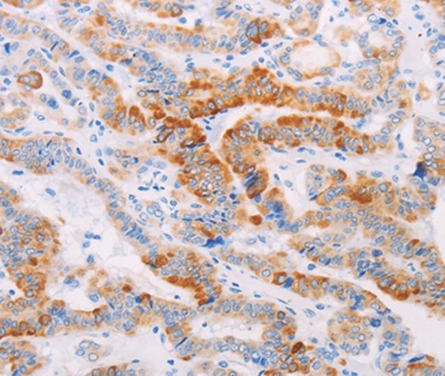 MAP4K3 Antibody in Immunohistochemistry (Paraffin) (IHC (P))