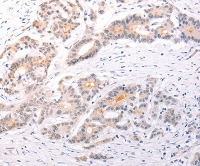 TRAF3IP1 Antibody in Immunohistochemistry (Paraffin) (IHC (P))