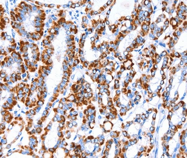 ACAA2 Antibody in Immunohistochemistry (Paraffin) (IHC (P))