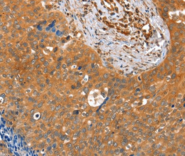 ACOT11 Antibody in Immunohistochemistry (Paraffin) (IHC (P))