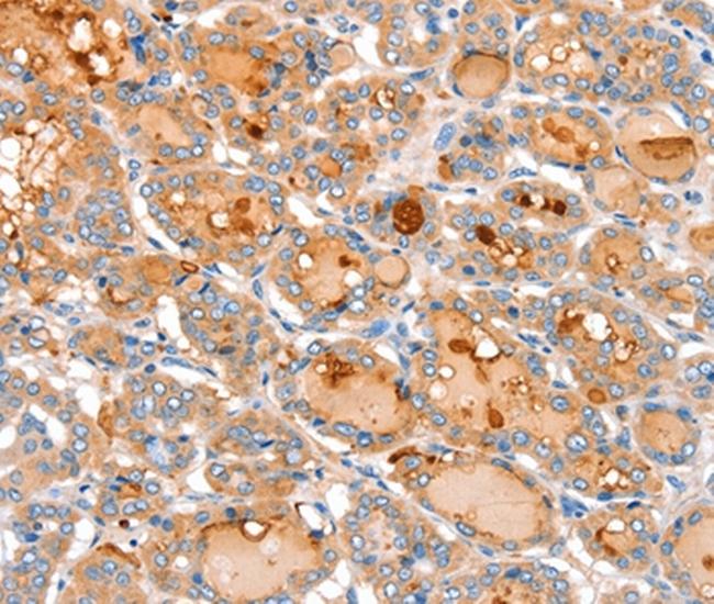 ACOX2 Antibody in Immunohistochemistry (Paraffin) (IHC (P))