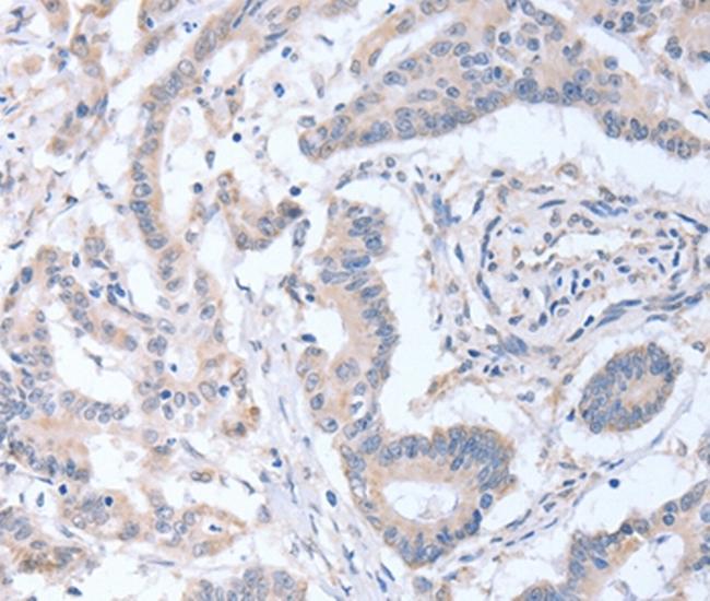 ACOT9 Antibody in Immunohistochemistry (Paraffin) (IHC (P))