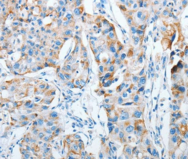 AGA Antibody in Immunohistochemistry (Paraffin) (IHC (P))