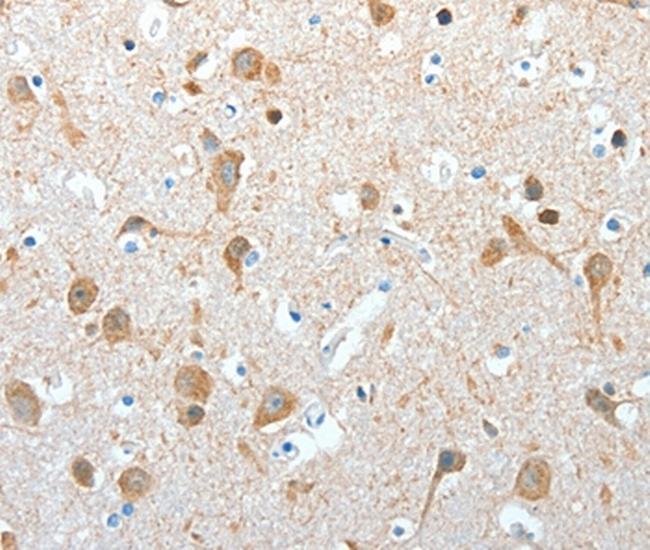 AKAP4 Antibody in Immunohistochemistry (Paraffin) (IHC (P))