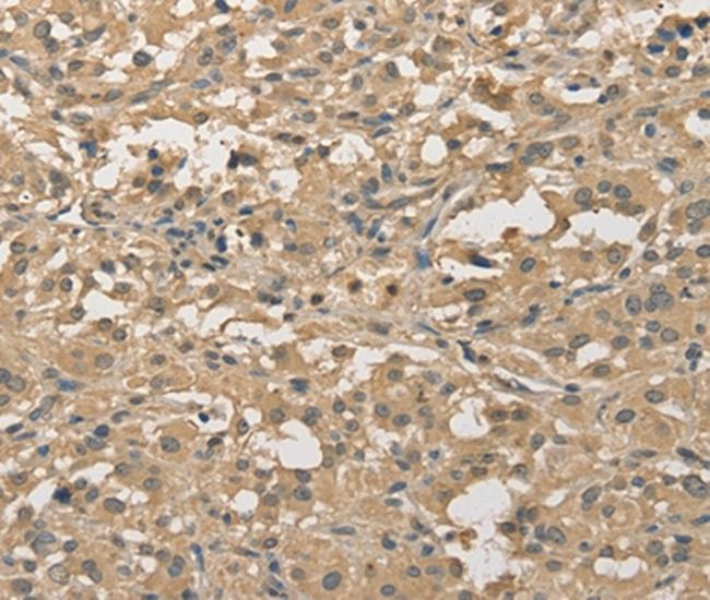 ALDH8A1 Antibody in Immunohistochemistry (Paraffin) (IHC (P))