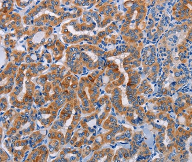 ALG12 Antibody in Immunohistochemistry (Paraffin) (IHC (P))