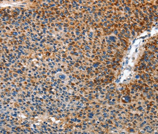 AMDHD2 Antibody in Immunohistochemistry (Paraffin) (IHC (P))