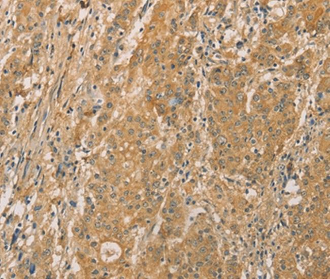 SNAP91 Antibody in Immunohistochemistry (Paraffin) (IHC (P))