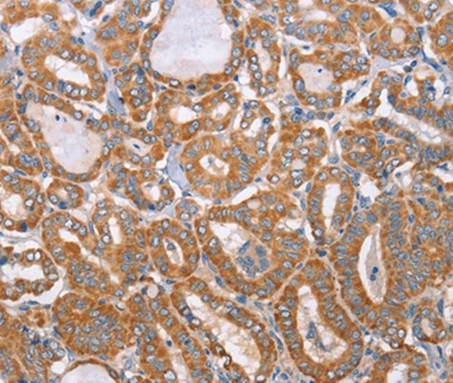 MTMR7 Antibody in Immunohistochemistry (Paraffin) (IHC (P))