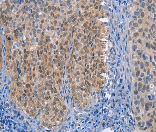 UCK1 Antibody in Immunohistochemistry (Paraffin) (IHC (P))