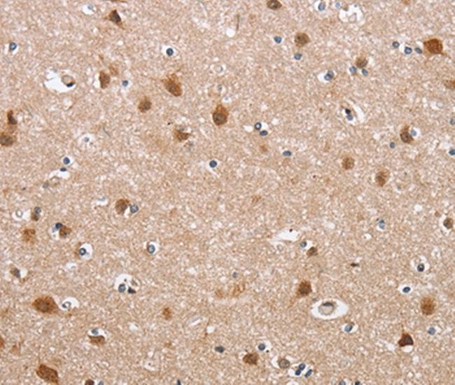 Defensin 6 Antibody in Immunohistochemistry (Paraffin) (IHC (P))