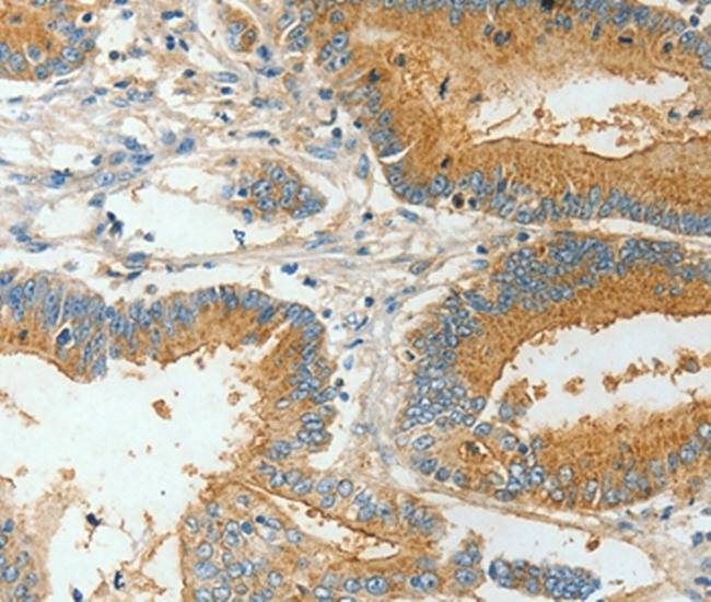 BAAT Antibody in Immunohistochemistry (Paraffin) (IHC (P))