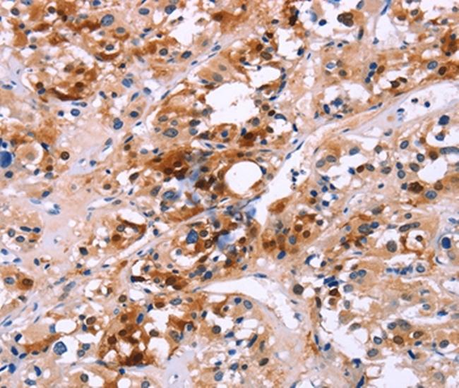 Calbindin D28K Antibody in Immunohistochemistry (Paraffin) (IHC (P))