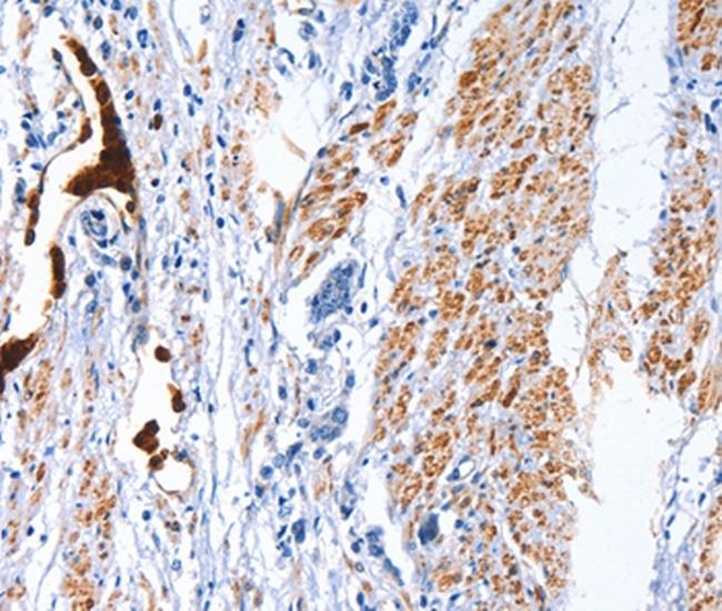 CATSPER1 Antibody in Immunohistochemistry (Paraffin) (IHC (P))