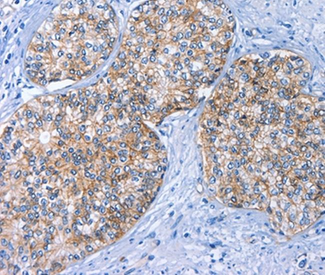 BCAM Antibody in Immunohistochemistry (Paraffin) (IHC (P))