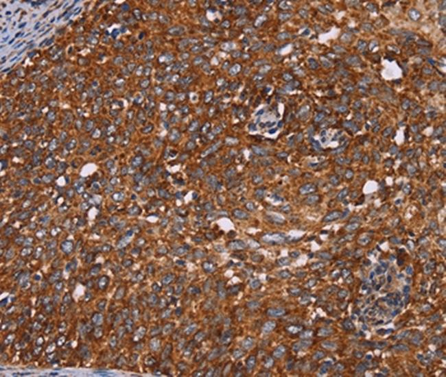 CYP2W1 Antibody in Immunohistochemistry (Paraffin) (IHC (P))