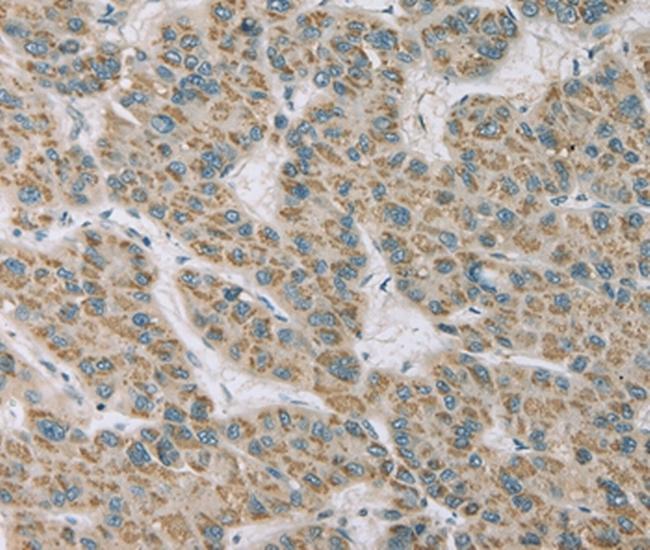 RNASE3 Antibody in Immunohistochemistry (Paraffin) (IHC (P))