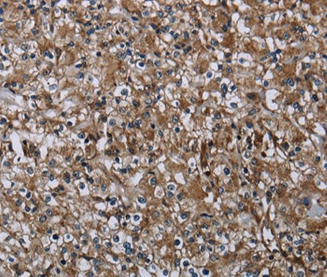 FAM89B Antibody in Immunohistochemistry (Paraffin) (IHC (P))