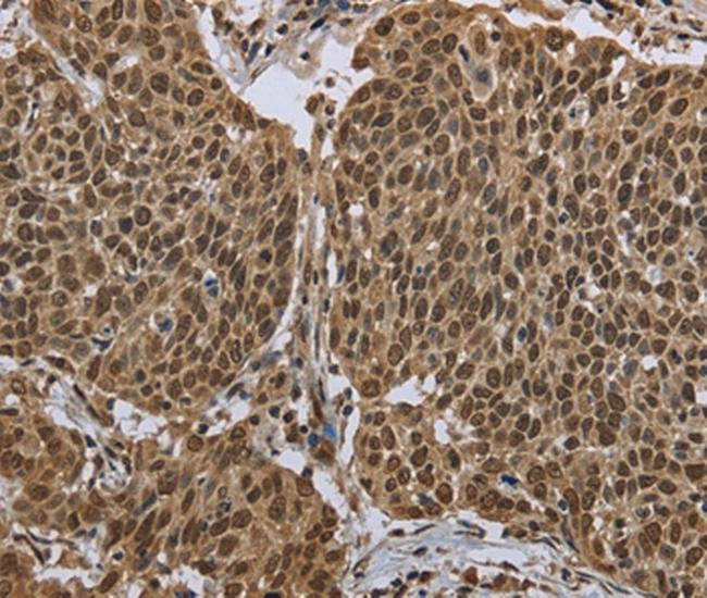 PPAT Antibody in Immunohistochemistry (Paraffin) (IHC (P))