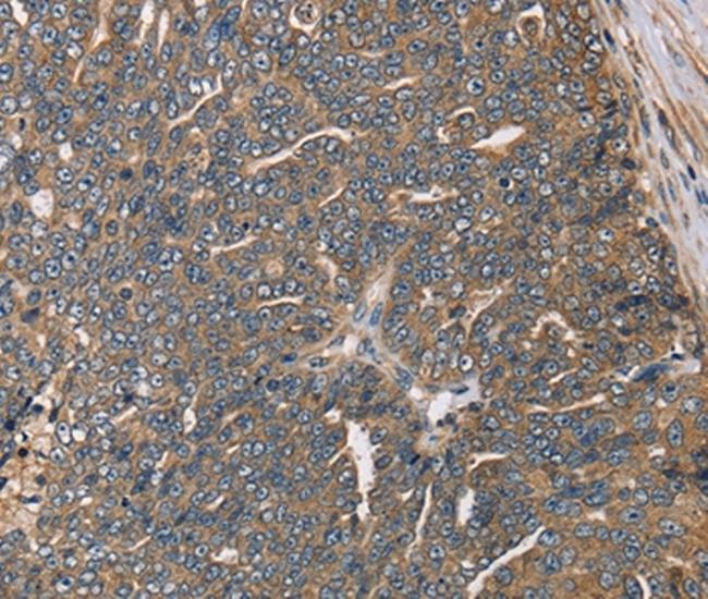 HSD17B12 Antibody in Immunohistochemistry (Paraffin) (IHC (P))