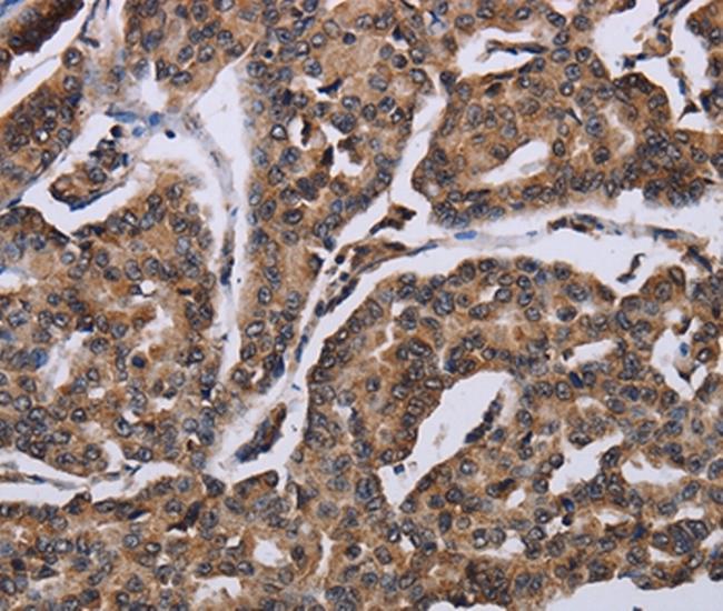 KIF1C Antibody in Immunohistochemistry (Paraffin) (IHC (P))