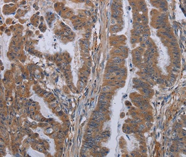 Kallikrein 8 Antibody in Immunohistochemistry (Paraffin) (IHC (P))