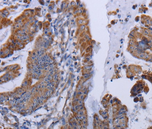 MT3 Antibody in Immunohistochemistry (Paraffin) (IHC (P))