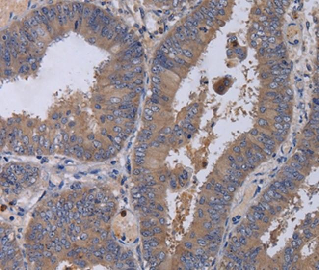 MKKS Antibody in Immunohistochemistry (Paraffin) (IHC (P))