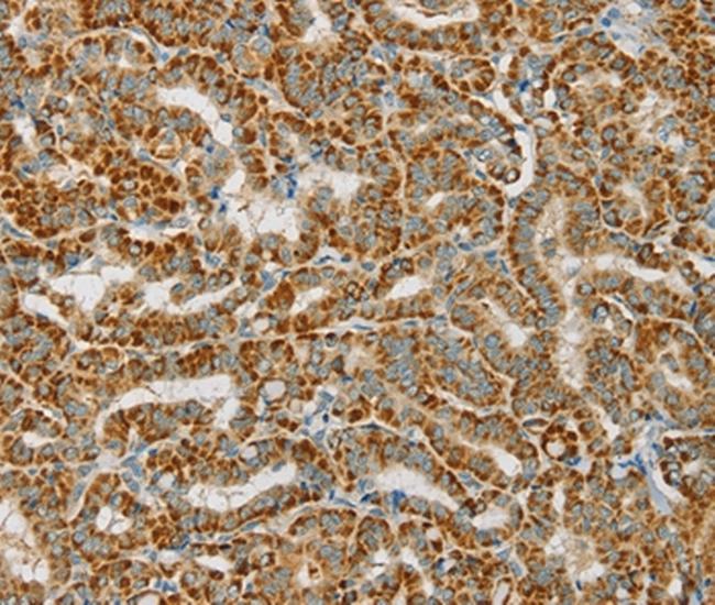 PDP1 Antibody in Immunohistochemistry (Paraffin) (IHC (P))