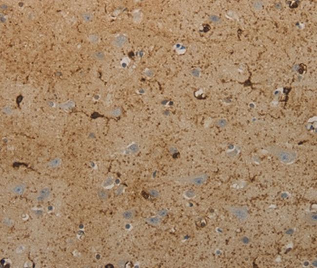 AATK Antibody in Immunohistochemistry (Paraffin) (IHC (P))