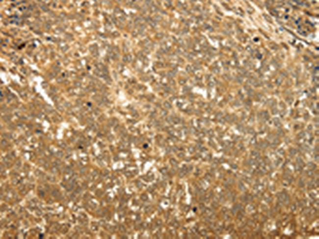 RAB26 Antibody in Immunohistochemistry (Paraffin) (IHC (P))