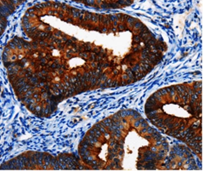 BRUCE Antibody in Immunohistochemistry (Paraffin) (IHC (P))