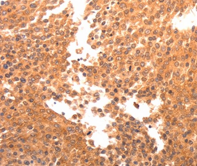 BDKRB2 Antibody in Immunohistochemistry (Paraffin) (IHC (P))