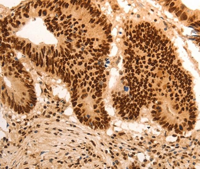 E2F7 Antibody in Immunohistochemistry (Paraffin) (IHC (P))