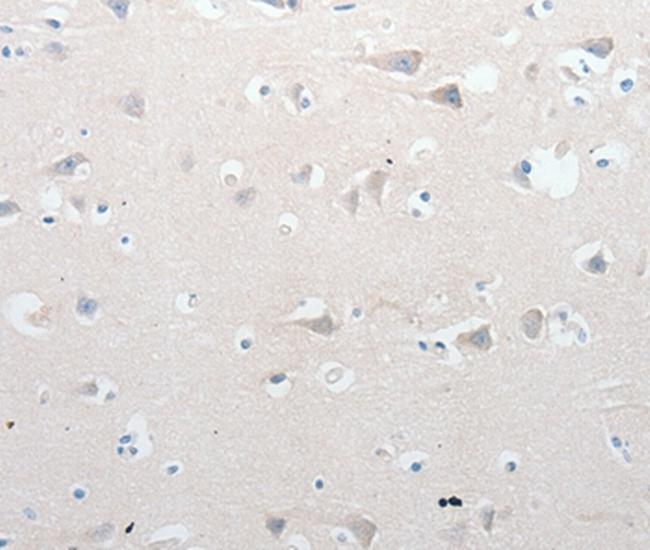 GCH1 Antibody in Immunohistochemistry (Paraffin) (IHC (P))