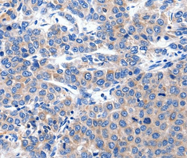 KCNH8 Antibody in Immunohistochemistry (Paraffin) (IHC (P))