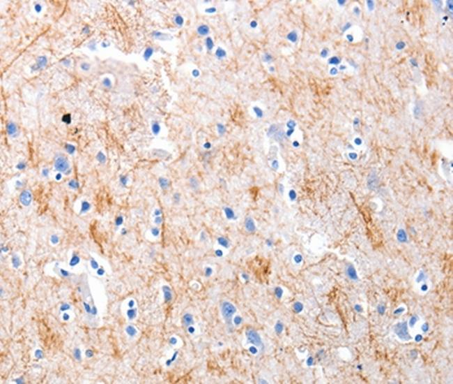 KISS1 Antibody in Immunohistochemistry (Paraffin) (IHC (P))