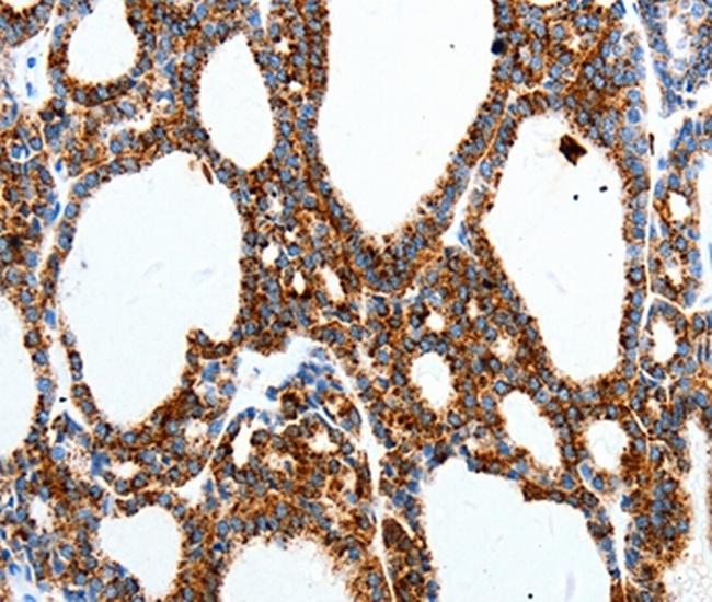 MTNR1A Antibody in Immunohistochemistry (Paraffin) (IHC (P))