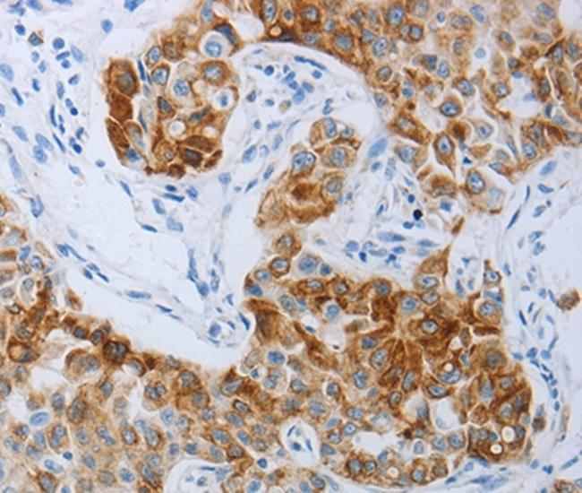 P2Y4 Antibody in Immunohistochemistry (Paraffin) (IHC (P))